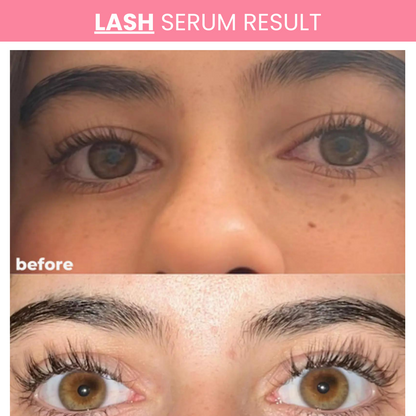 Lash & Brow Serum Duo – Natural Growth for Thicker, Darker Lashes