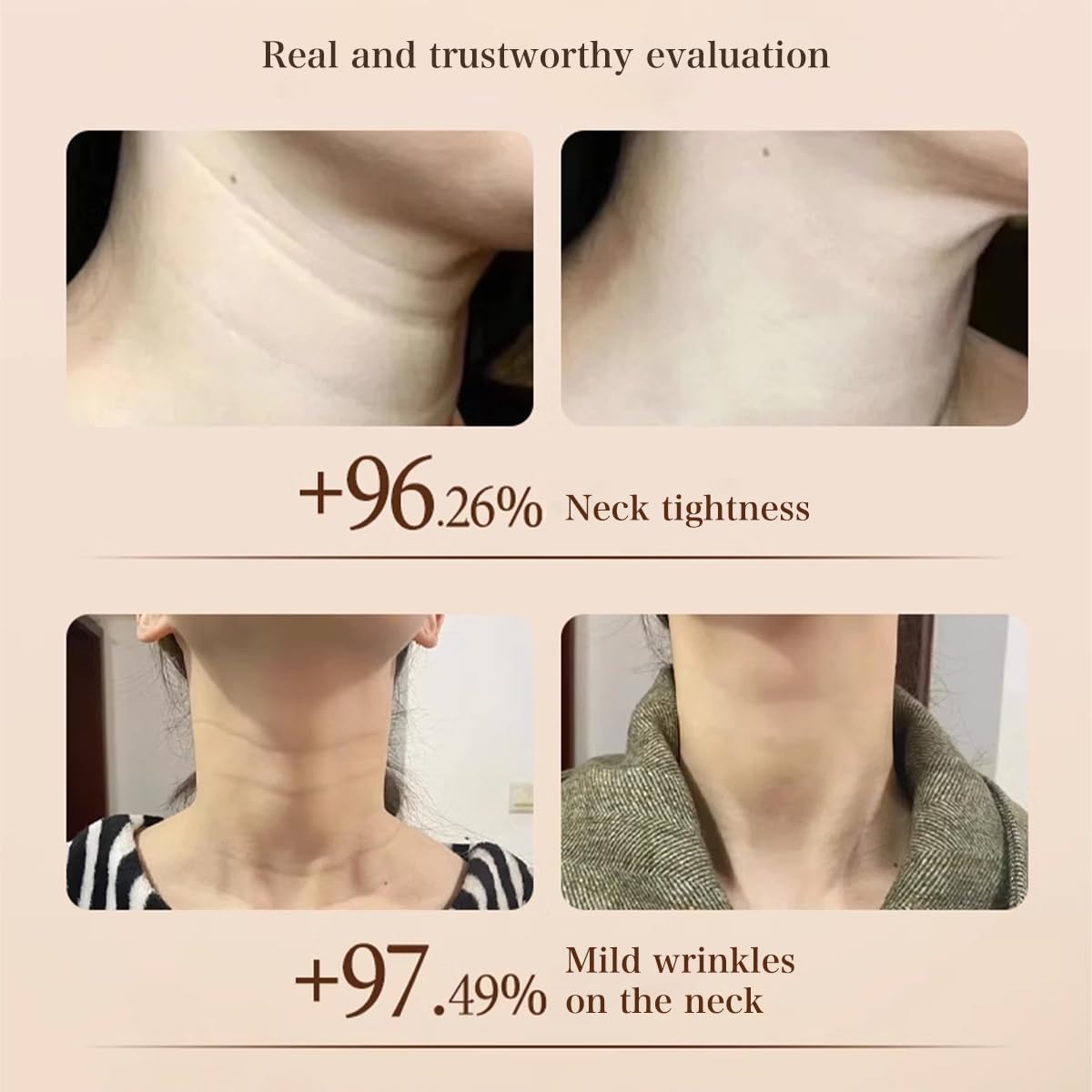 Moisturizing Neck Cream – Firming & Smoothing for Fine Lines