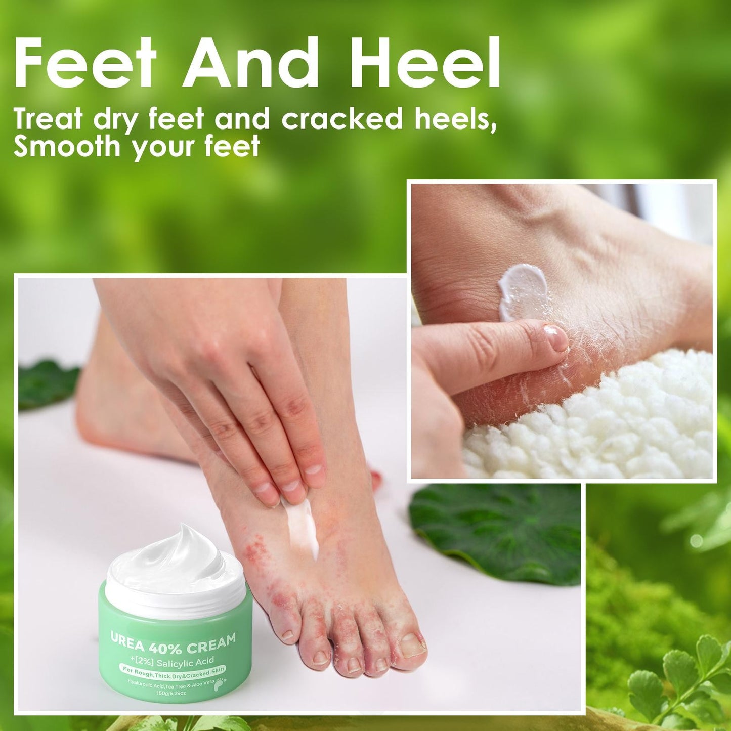 Urea Cream 40% + Salicylic Acid – Foot & Hand Cream, 5.29 oz