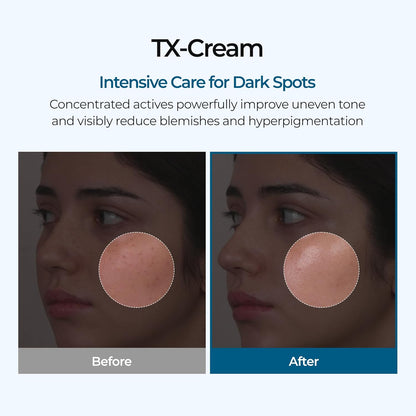 TX Tranexamic Acid Cream – Dark Spot & Tone Care, 50ml
