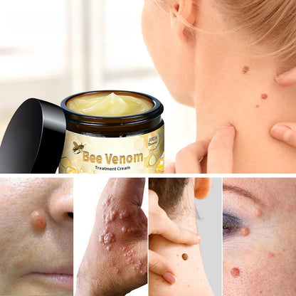 Bee Venom Skin Care Cream – Deep Hydration & Skin-Smoothing Moisturizer for All Skin Types