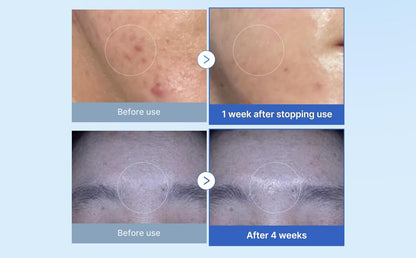 Zero Exosome Shot 25,000 PPM Spicule Serum – Skin Booster