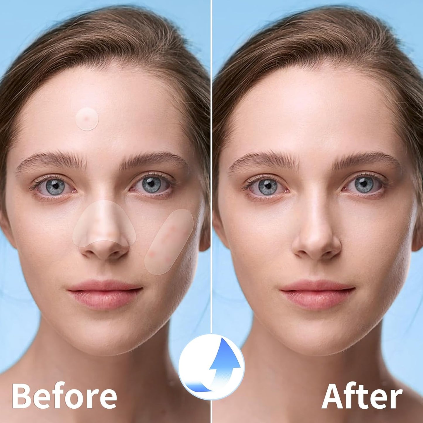 Pimple Patches for Face – Hydrocolloid Acne Stickers with Tea Tree & Cica