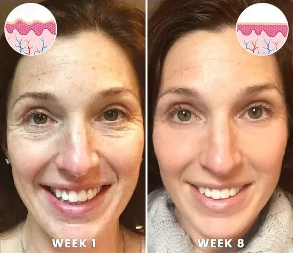 Renewal Serum – Daily Moisturizing & Skin Smoothing Serum