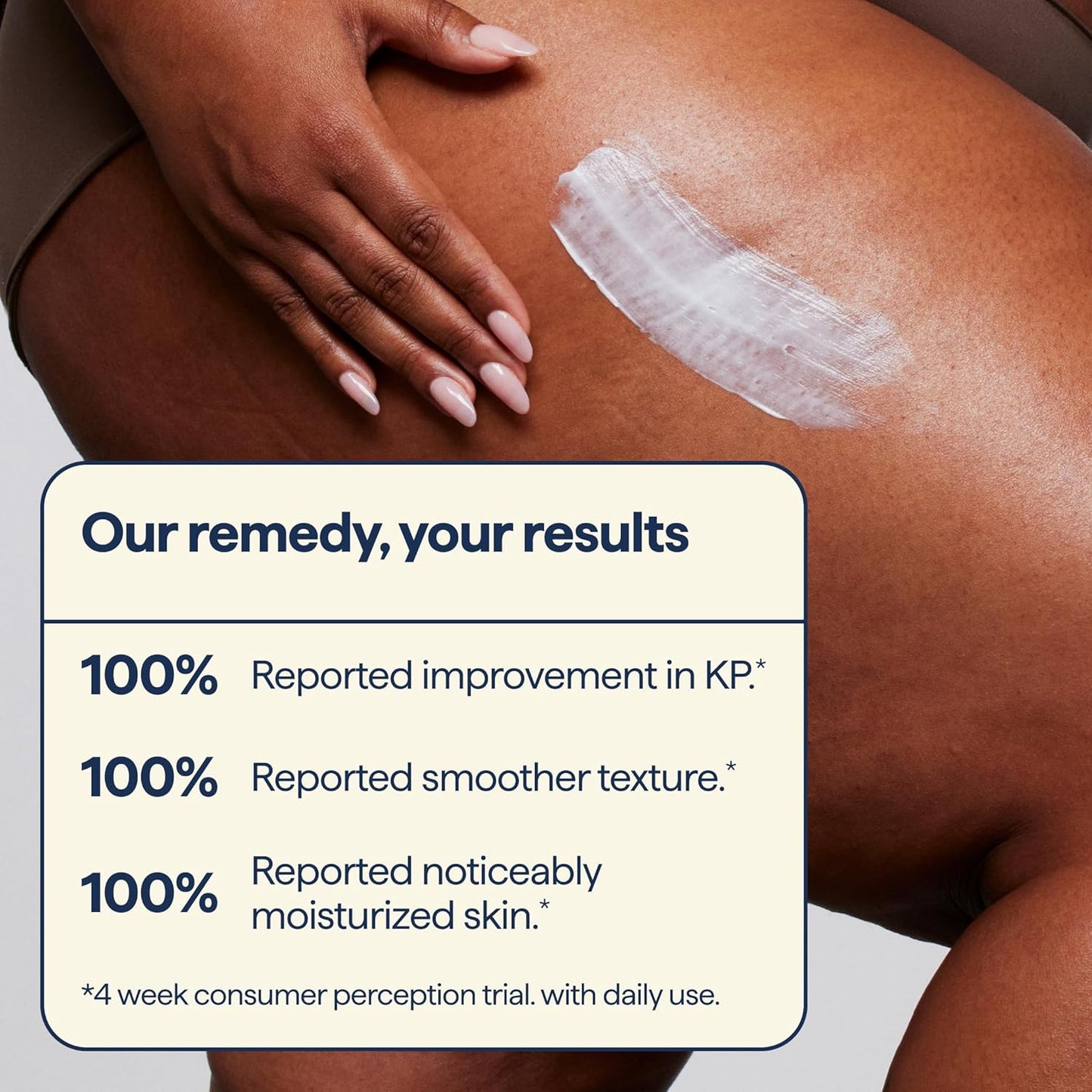 Remedy for Body Bumps – Smoothing Lotion with Urea & Retinol