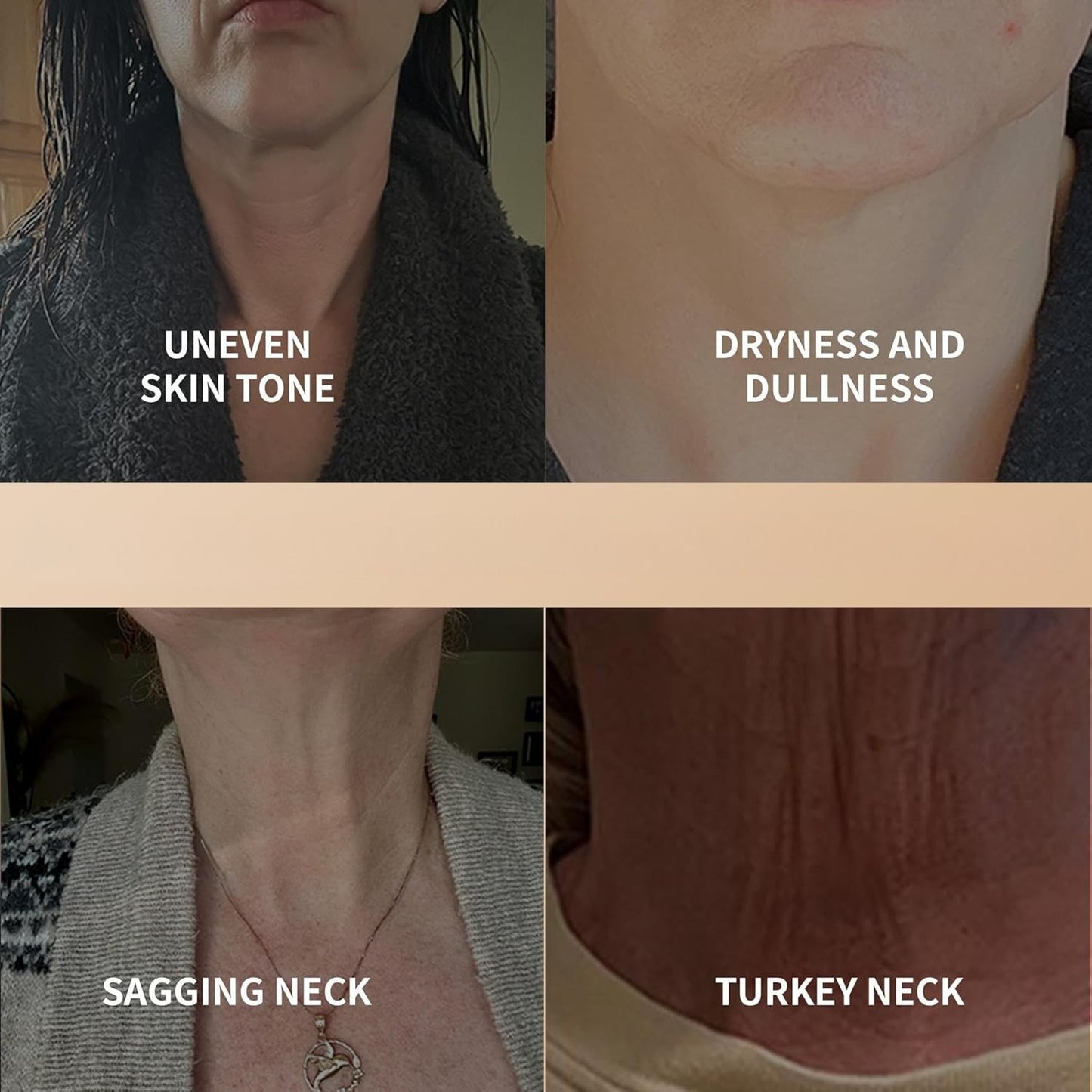 Ycz AH-8 Firming Neck Cream – Moisturizing & Tightening for Crepey Skin