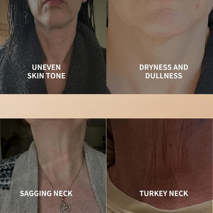 Ycz AH-8 Firming Neck Cream – Moisturizing & Tightening for Crepey Skin