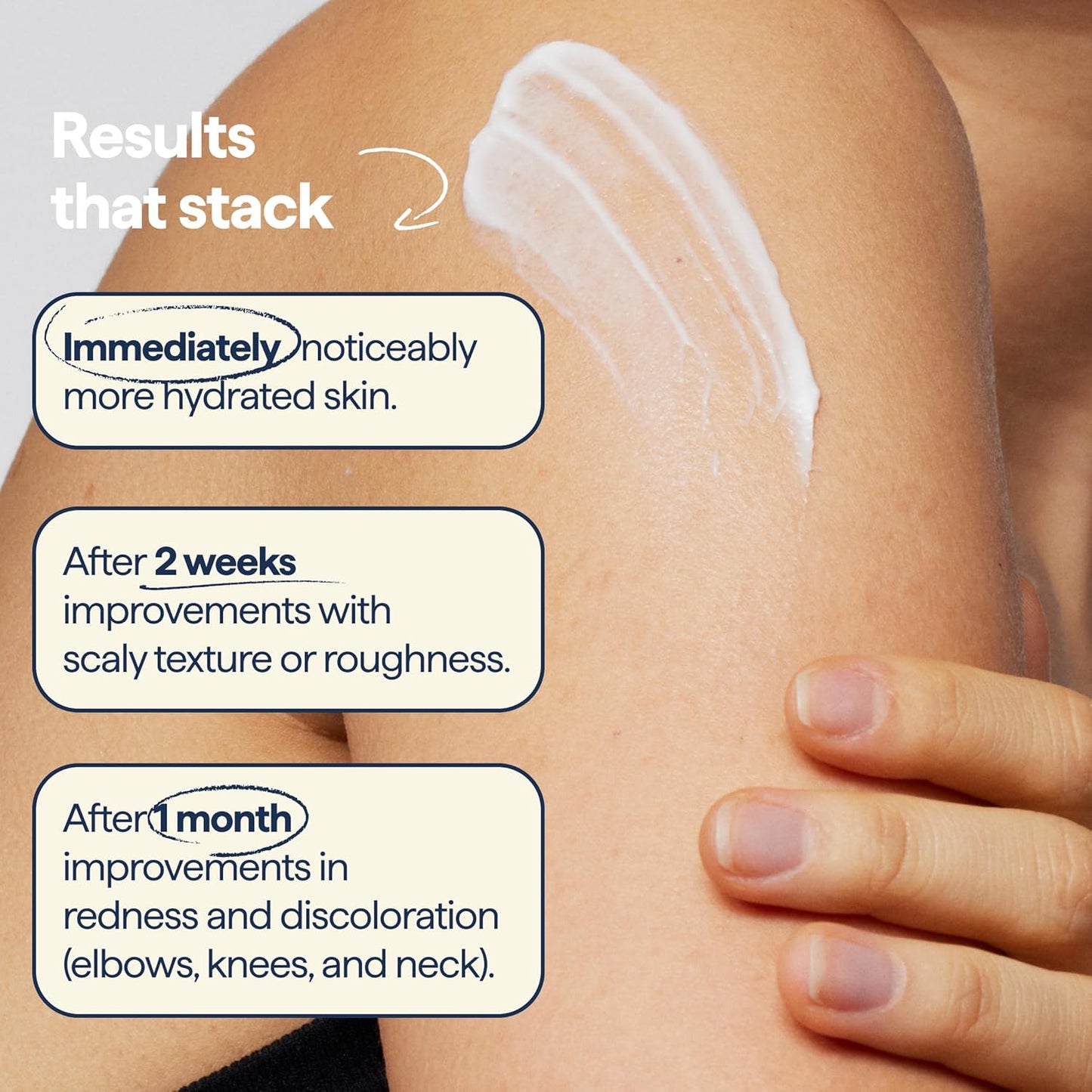 Remedy for Body Bumps – Smoothing Lotion with Urea & Retinol
