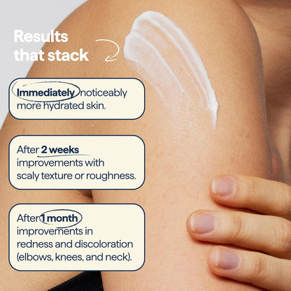 Remedy for Body Bumps – Smoothing Lotion with Urea & Retinol