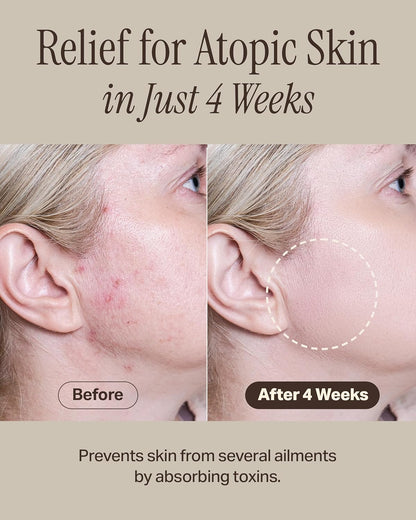 Relief Mud Mask + Foam Facial Cleanser Bundle