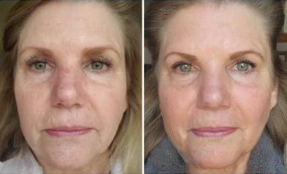 Glyco-Peptide Anti Wrinkle Face Cream – Hydrating Moisturizer