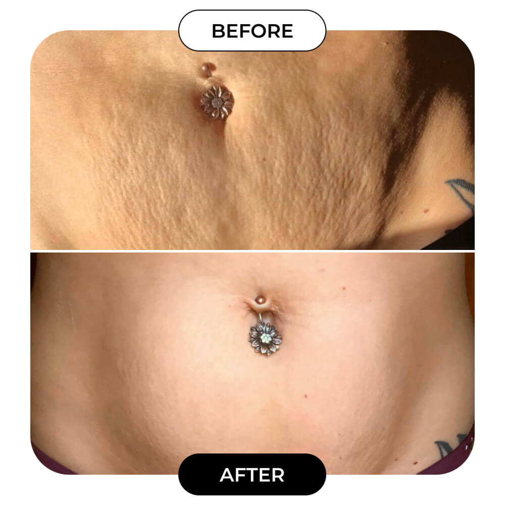 B-FLAT Belly Firming Cream - Tightening & Smoothing Formula for a Toned Look
