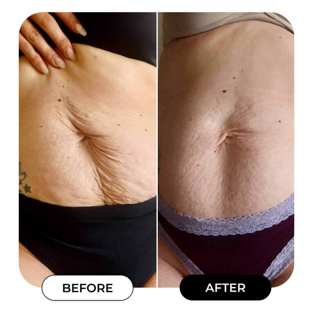 B-FLAT Belly Firming Cream - Tightening & Smoothing Formula for a Toned Look