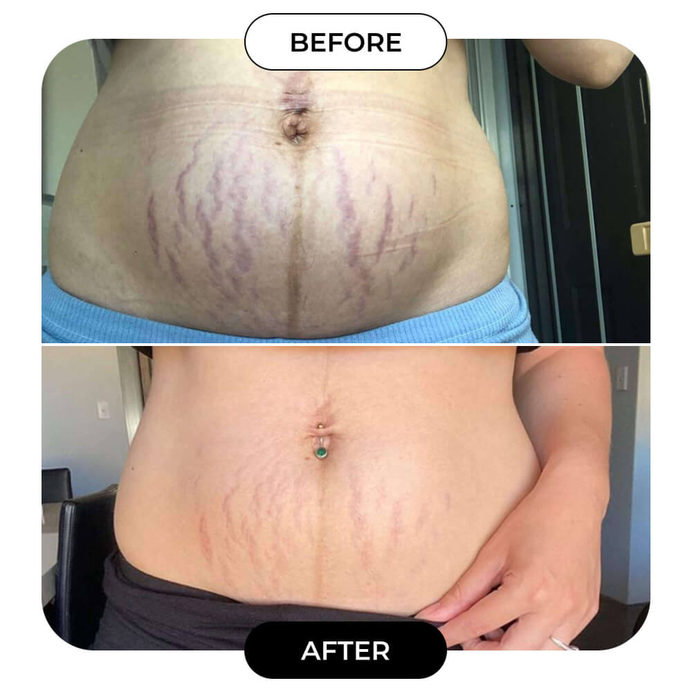 B-FLAT Belly Firming Cream - Tightening & Smoothing Formula for a Toned Look