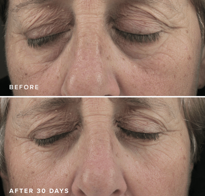 Brightening Eye Masks – Hydrating Under Eye Patches