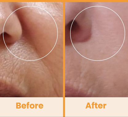 NuDerma Standard High Frequency Wand – Facial Skincare Tool