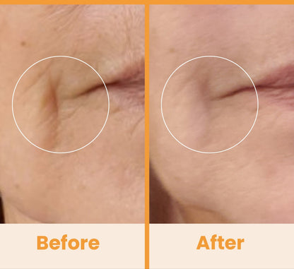 NuDerma Standard High Frequency Wand – Facial Skincare Tool