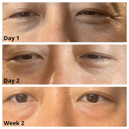 Caffeine Eye Cream – Lightweight Under Eye Moisturizer