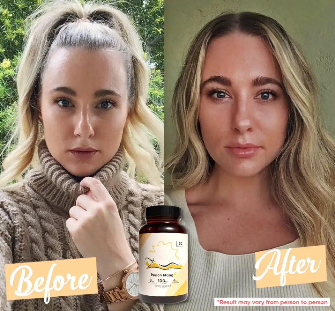Super Tanning Daily Gummies – Enhance Natural Tan & Skin Glow