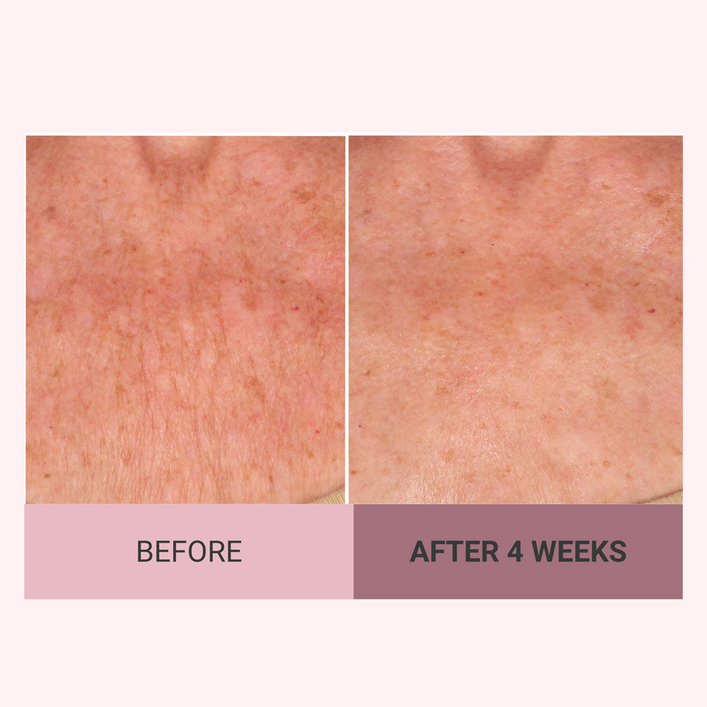 Champagne Beaute Lift Body Crème – Firming & Hydrating Lotion