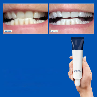Nano-Hydroxyapatite Toothpaste – Whitens, Strengthens & Protects Teeth