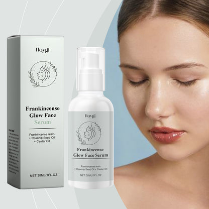 Frankincense Resin Glow Face Drops – Hydrating Nourishing Face Oil for Glowing Skin