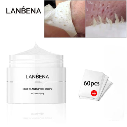 LANBENA Blackhead Remover – Deep Cleansing Nose Mask & Pore Strip