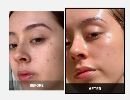 AGE-R Booster H - Skin Care Device for Enhanced Absorption and Radiant Glow Boost