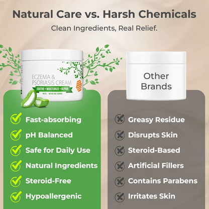 Eczema & Psoriasis Cream – Soothing Moisturizer for Dry Skin