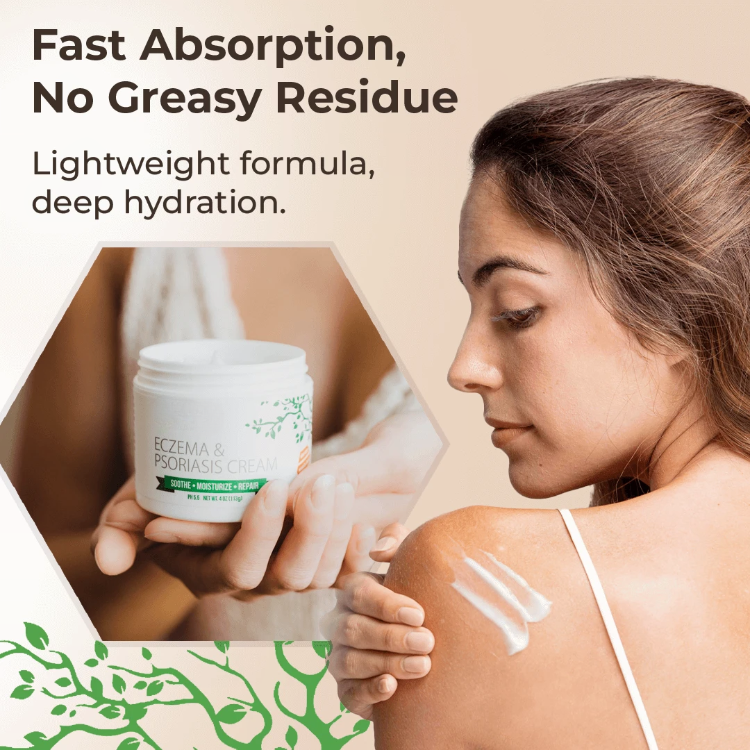 Eczema & Psoriasis Cream – Soothing Moisturizer for Dry Skin