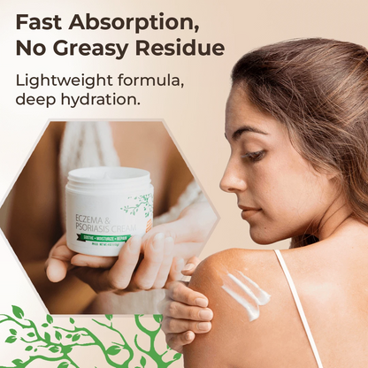 Eczema & Psoriasis Cream – Soothing Moisturizer for Dry Skin