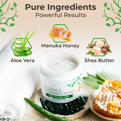 Eczema & Psoriasis Cream – Soothing Moisturizer for Dry Skin