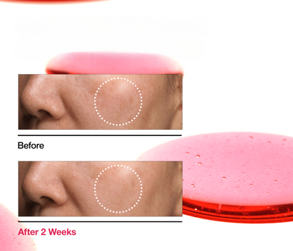 Niacinamide 10% + TXA 4% Serum – Daily Skin Balancing Formula