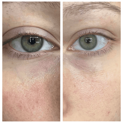 Caffeine Eye Cream – Lightweight Under Eye Moisturizer