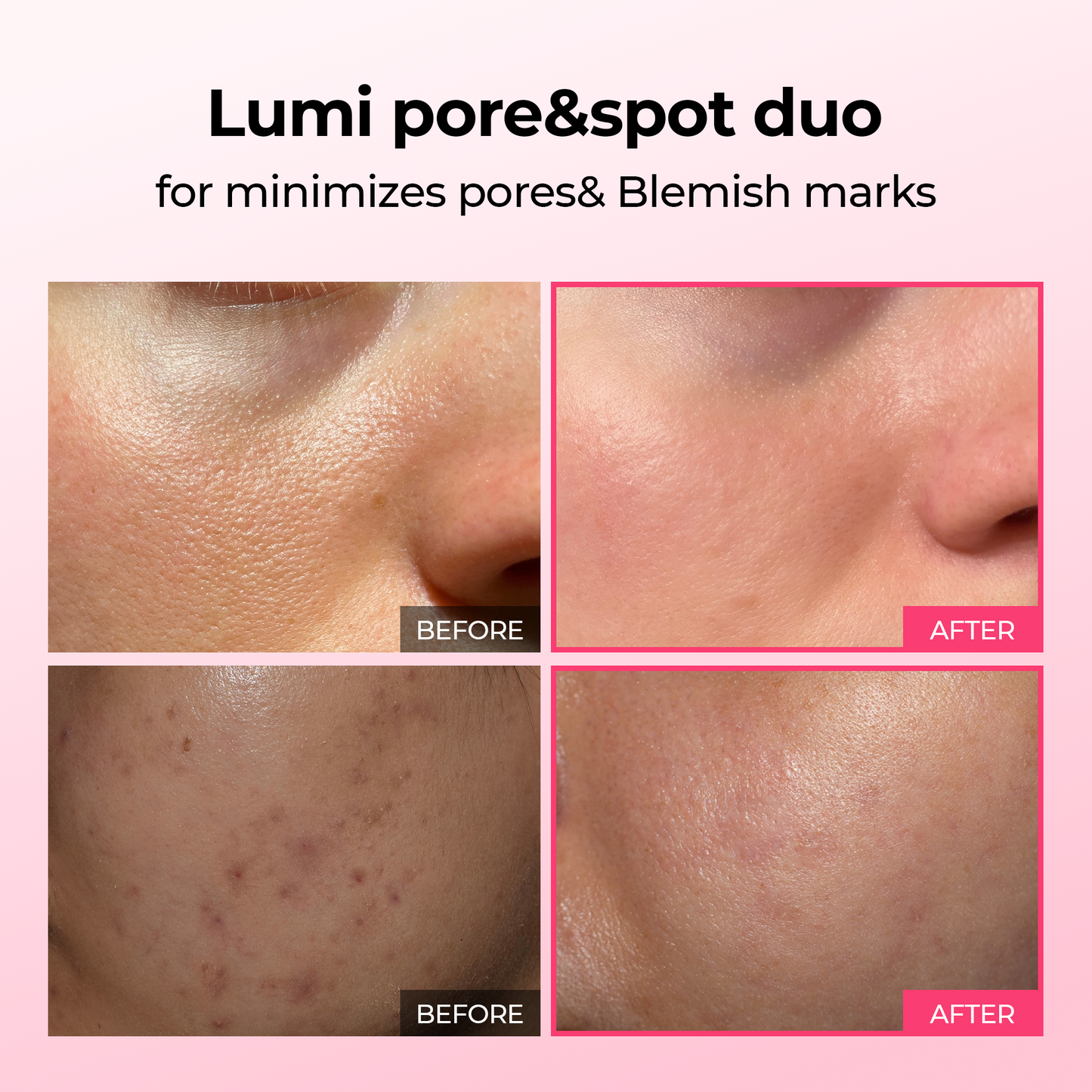 Lumi Pore & Spot Care Duo – Clarifying & Brightening Set