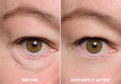 Instant FirmX Easy Wear Eye Tightener – Temporary Firming Gel