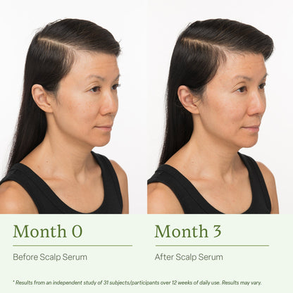 Healthy Scalp & Hair Serum – Lightweight Botanical Formula, 30 ml