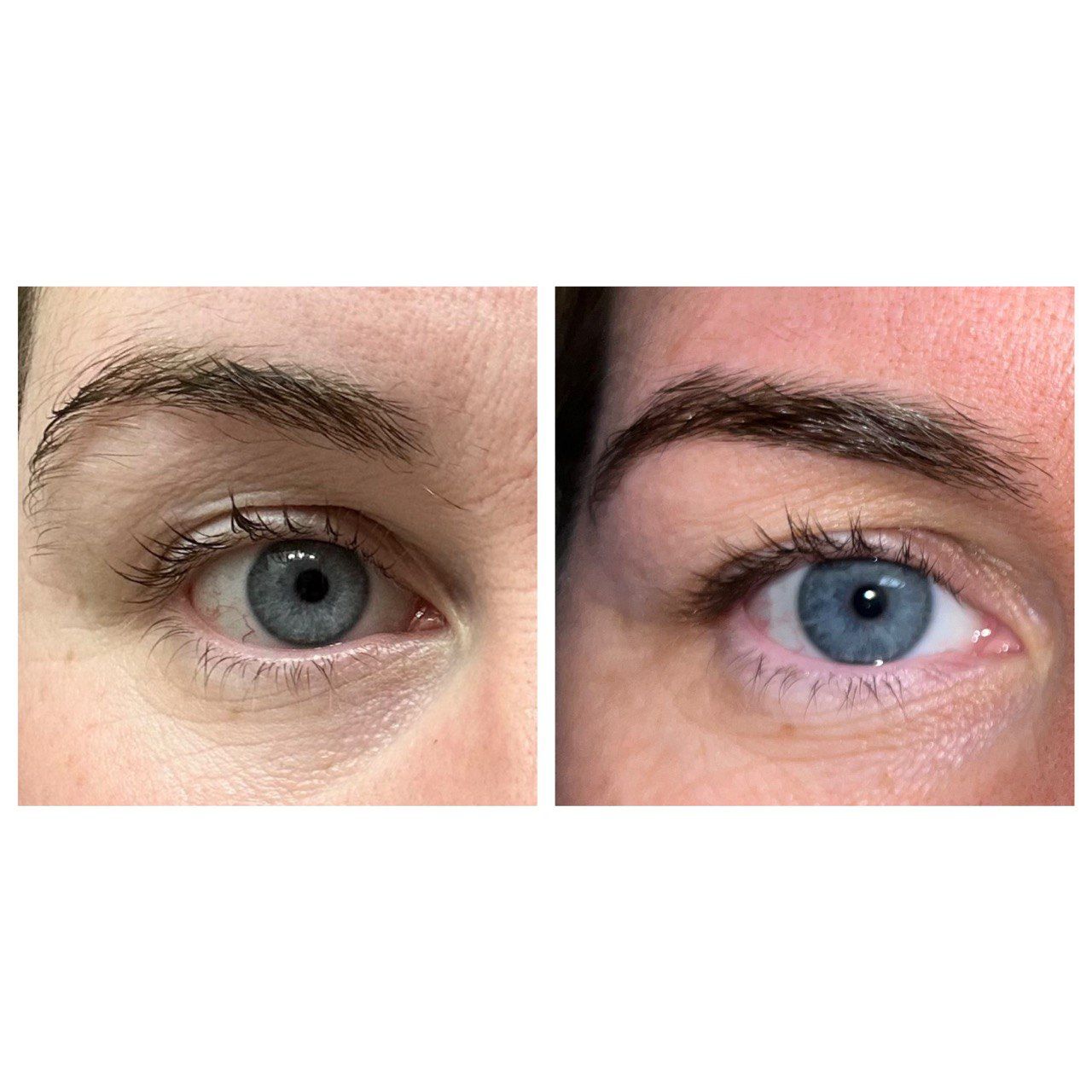 Eyebrow Serum – Enhance Fuller, Thicker Eyebrows Naturally