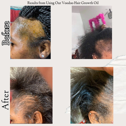 Natural Voodoo Hair Growth Oil - Nourishing Oil for Thicker, Stronger Hair