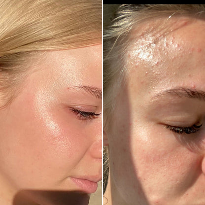 Mandelic Serum 5% – Gentle Exfoliating Serum for Clear, Smooth Skin