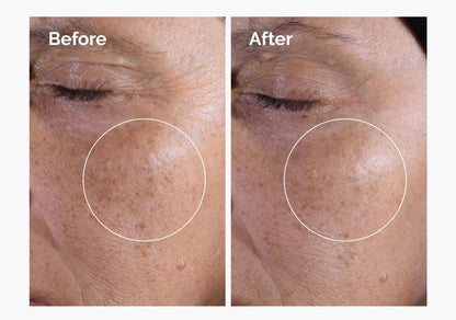 Glycolic Acid 7% Exfoliating Toner – Brighten & Nourish Your Skin